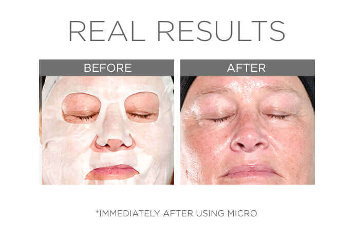 Micro Defense Microbiome Sheet Mask Set, 5-pcs - Image 4